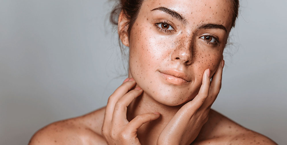 Cómo Combatir las Manchas y la Pigmentación con Productos Naturales